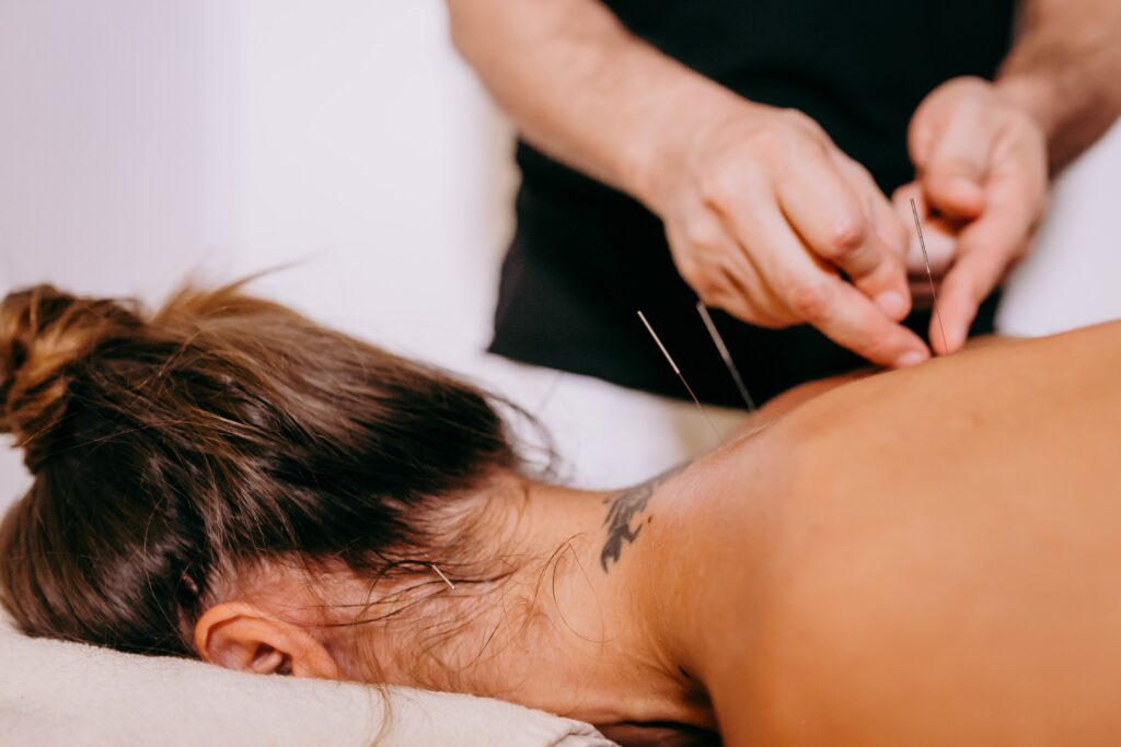 Acupuncture for chronic pain